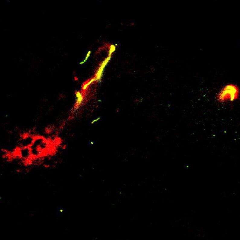Host response to immunotherapy induces blood-brain-barrier disruption