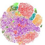 Improving immunotherapy outcome in resistant tumors